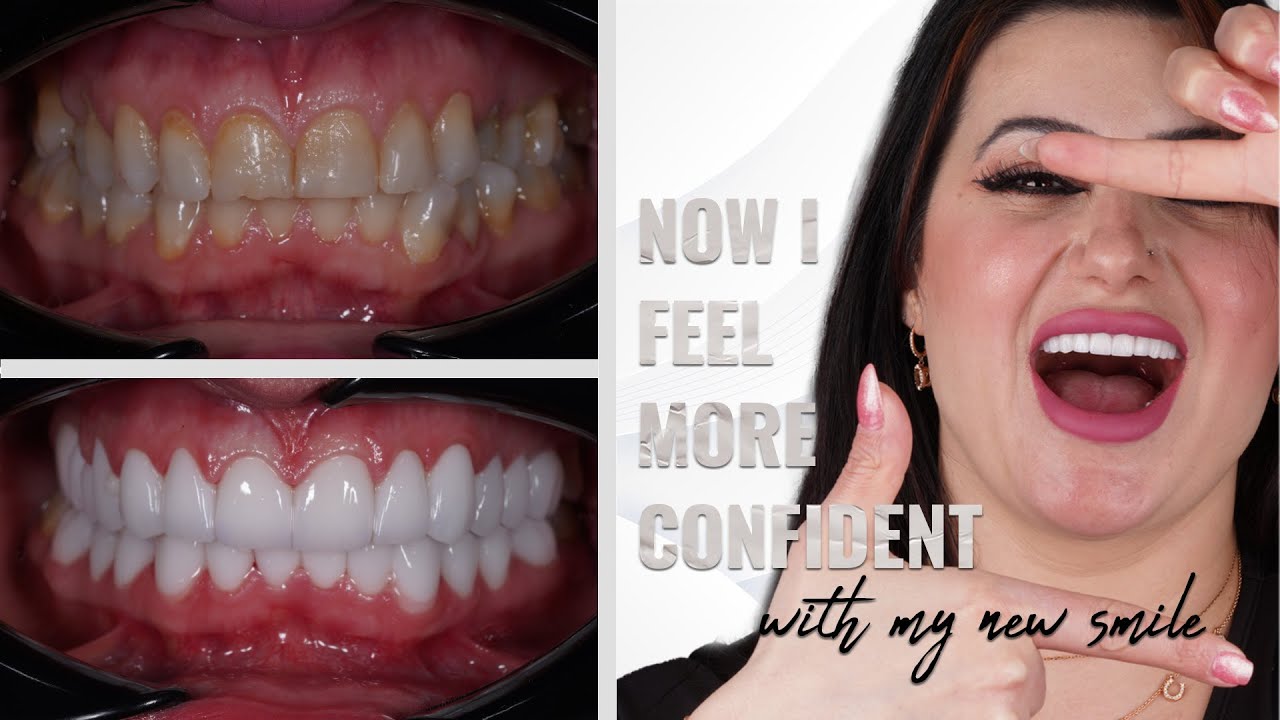 NOW I FEEL MORE CONFIDENT | INTERNATIONAL PLUS
