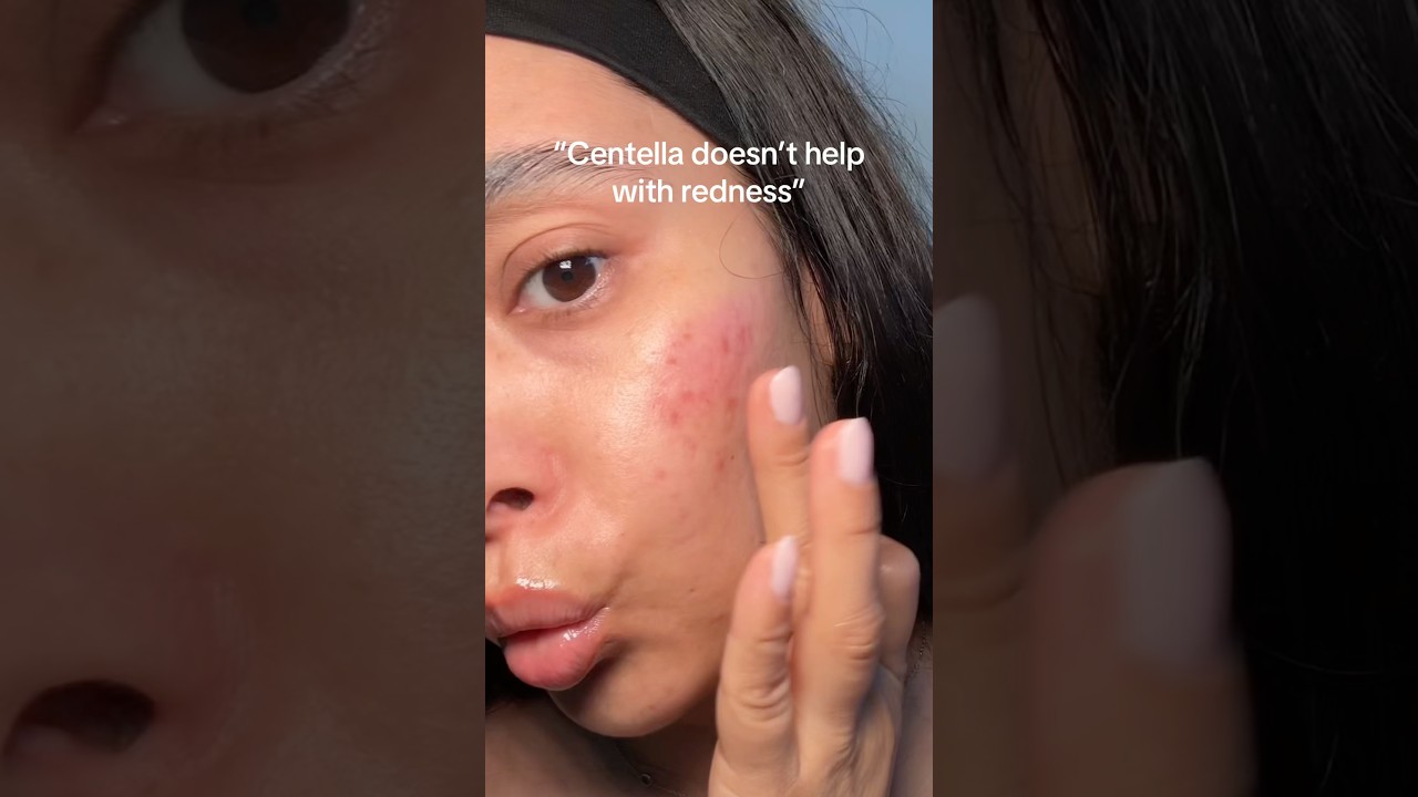 How to soothe and reduce redness with centella. Centella unscented serum from Purito🩷#centella