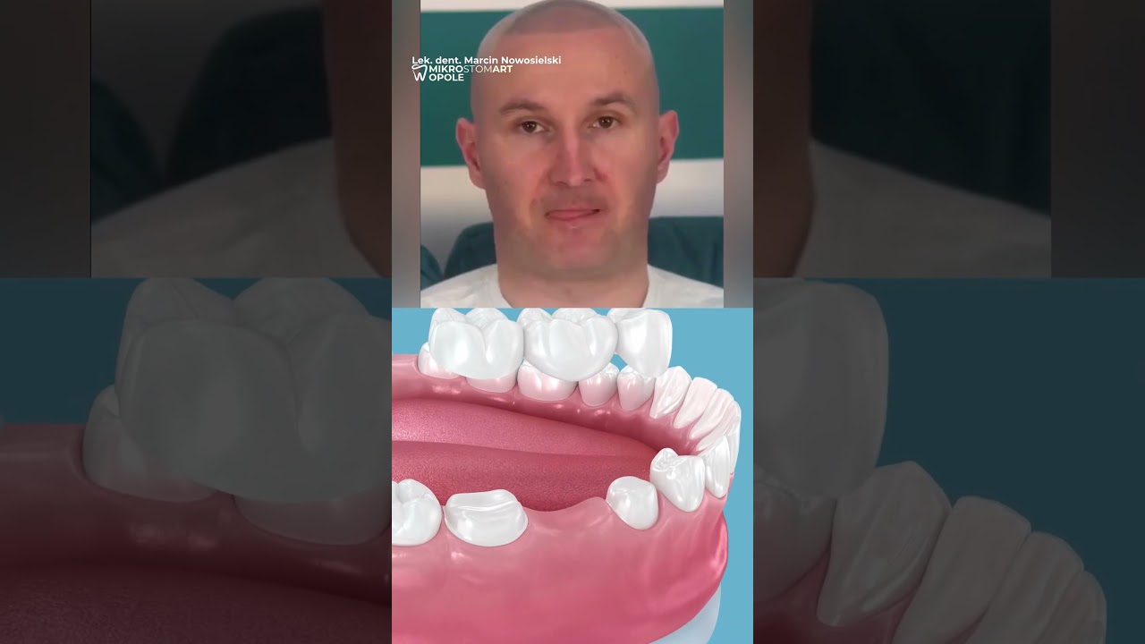 HOLYWOOD SMILE? 😁💫 Dentysta: NIE dla WSZYSTKICH! (Kiedy SUBTELNOŚĆ jest WAŻNIEJSZA od EFEKTU WOW!