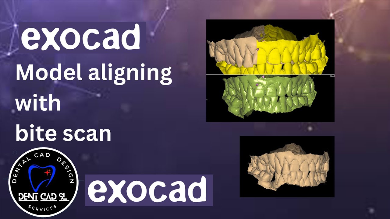 model aligning with bite scan