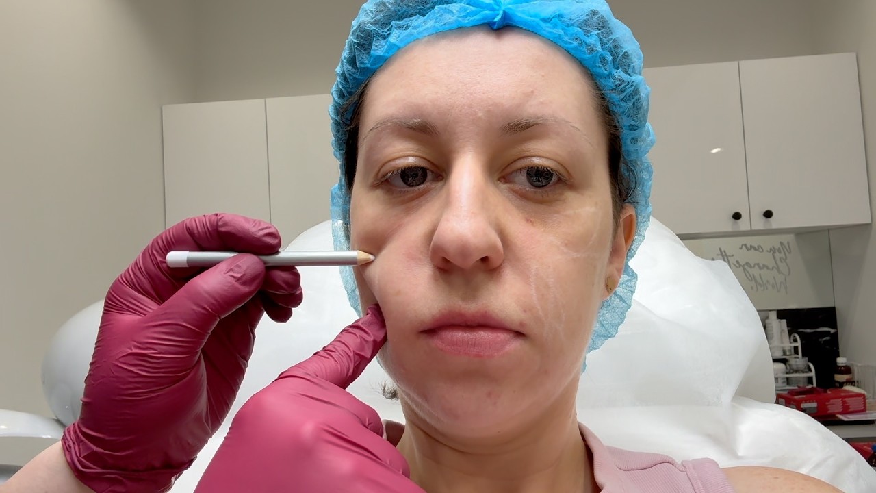 Trying Non-Surgical Face Lifting For The First Time ✨ Not What I Expected