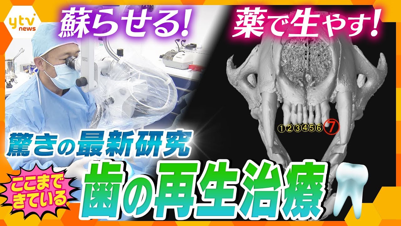神経を移植して&rdquo;死んだ歯&rdquo;を蘇生！薬を投与して&rdquo;第三の歯&rdquo;を生やす！「失ったら取り戻せない」という歯の常識を覆す、最新の再生医療とは？【かんさい情報ネットten.特集】