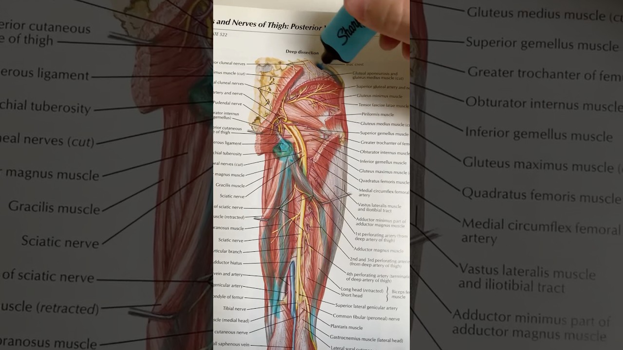 4 Gluteal Tendinopathy Exercises