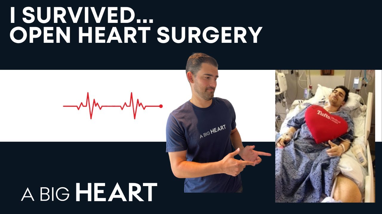 I SURVIVED open heart surgery