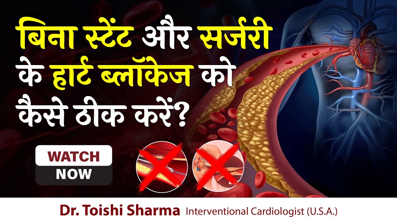 बिना स्टेंट और सर्जरी के हार्ट ब्लॉकेज को कैसे ठीक करें? Heart Blockage Treatment In Delhi, India