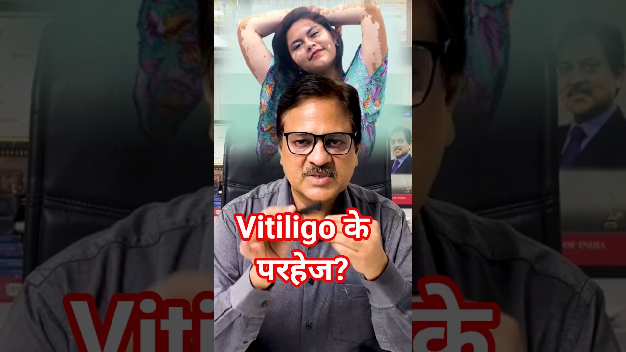 Vitiligo treatment by Dermatologist Dr Sandesh gupta. #skin #haircare