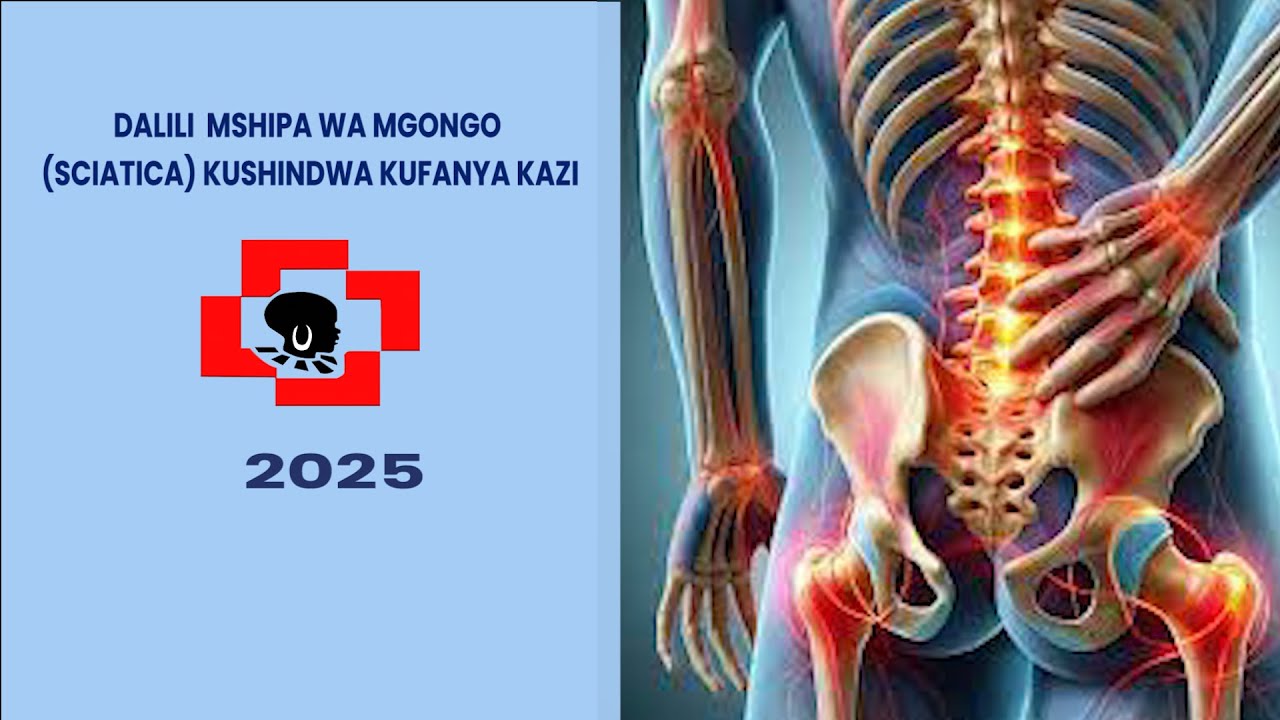 DALILI MSHIPA WA CHINI YA  MGONGO (SCIATICA)  KUSHINDWA KUFANYA KAZI NA HATUA ZA KUCHUKUA