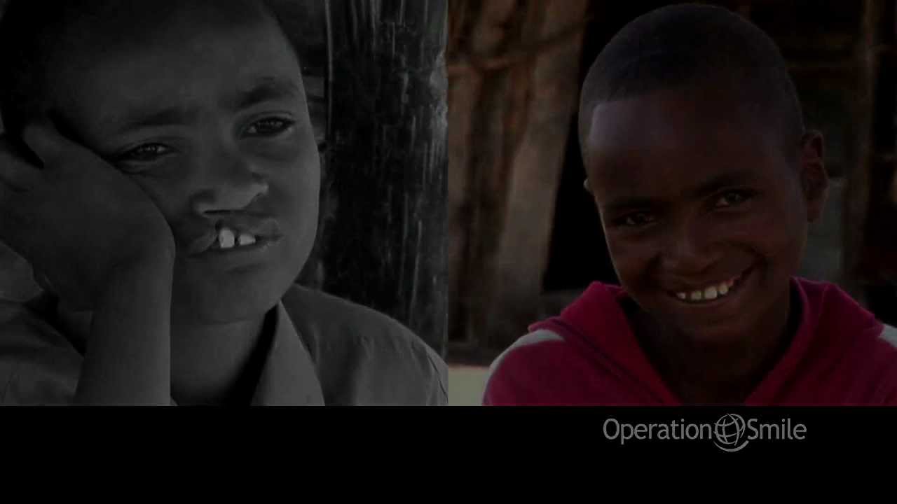 Life Before and After