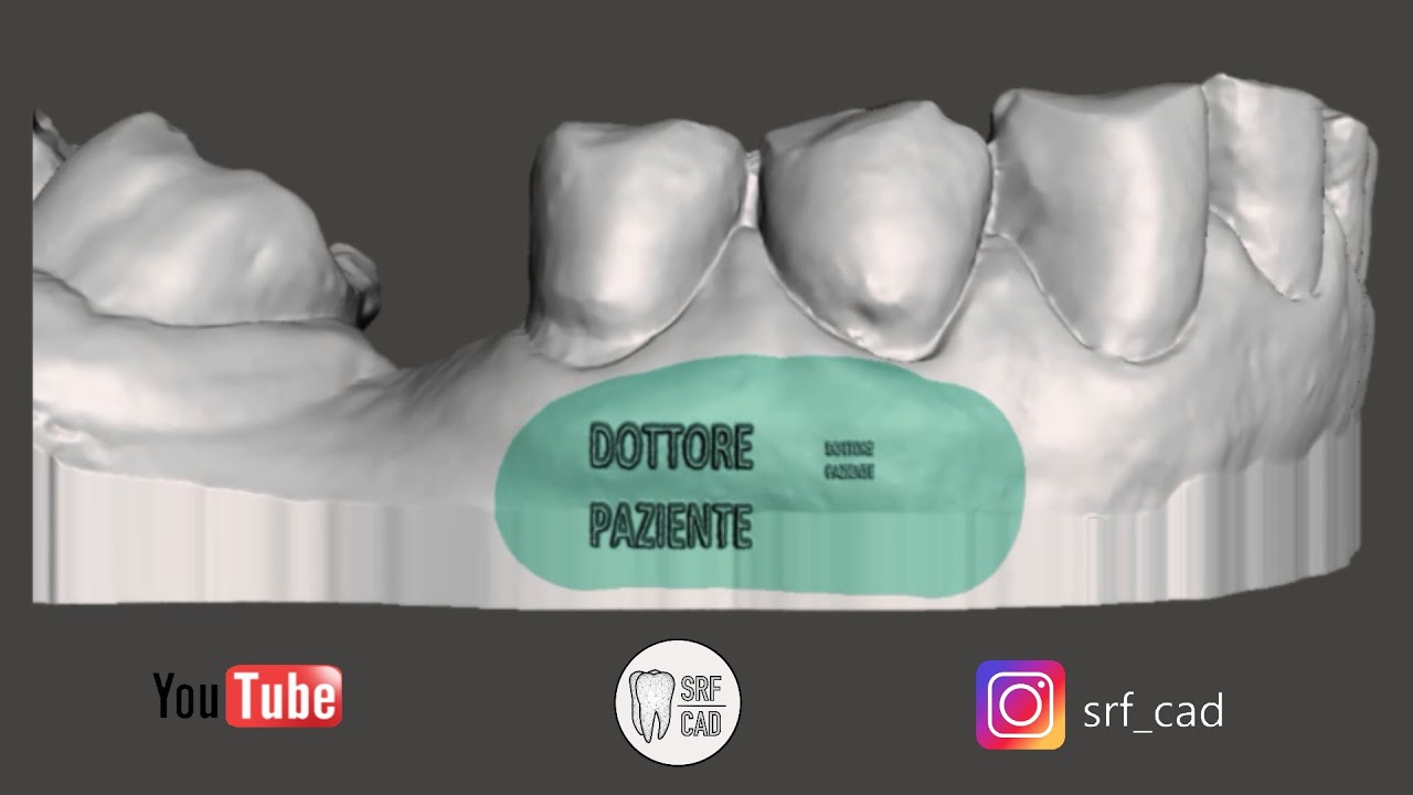 MESHMIXER DENTAL : Tutorial come creare un testo e adattarlo ad un modello Logo Stencil