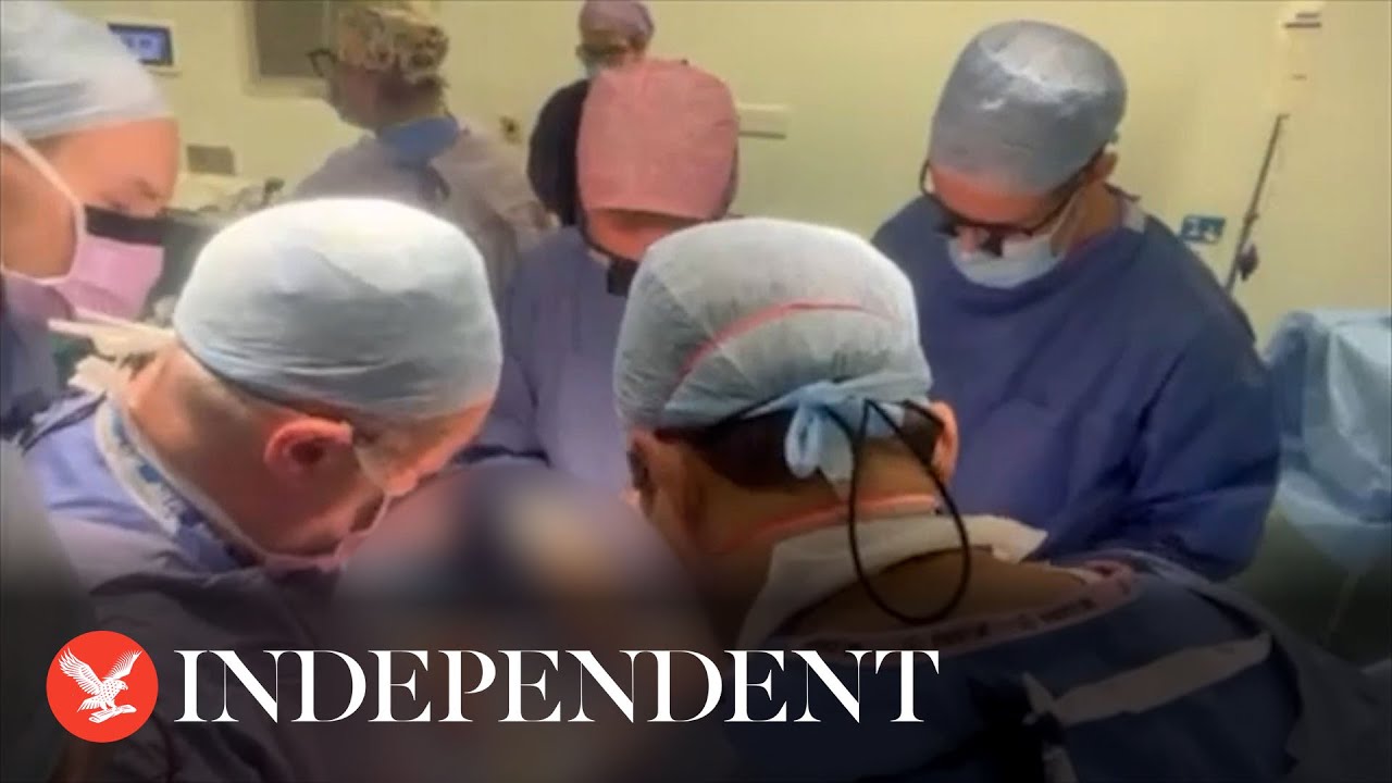 Surgeons perform UK’s first womb transplant with sister-to-sister donation