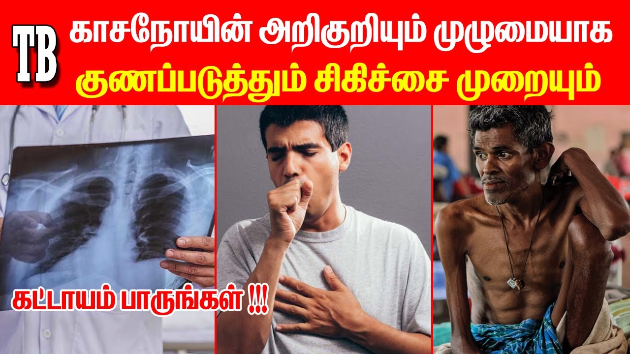 What is Tuberculosis | How to Prevent Tuberculosis | Tuberculosis Symptoms in Tamil | Doctor Advice