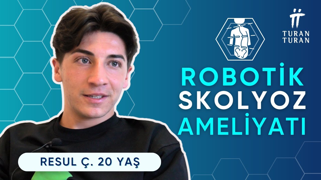Skolyozda %99.7 Doğruluk Payı! | Robotik Cerrahi ile 5 Günde Dik Durmaya Başladım