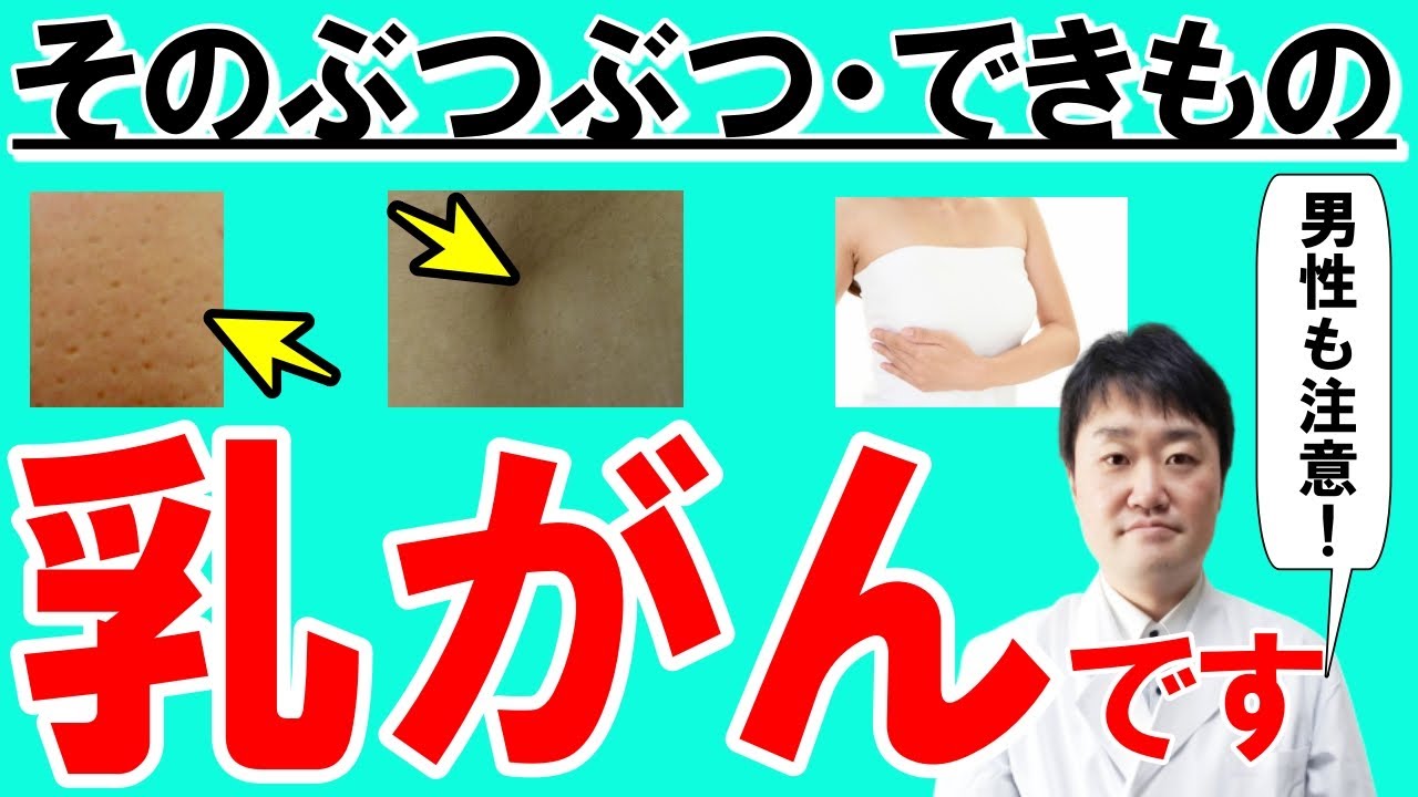 【放置厳禁】見逃すと絶対後悔する乳がんの意外な7つの初期症状とは？  がん専門医師が解説