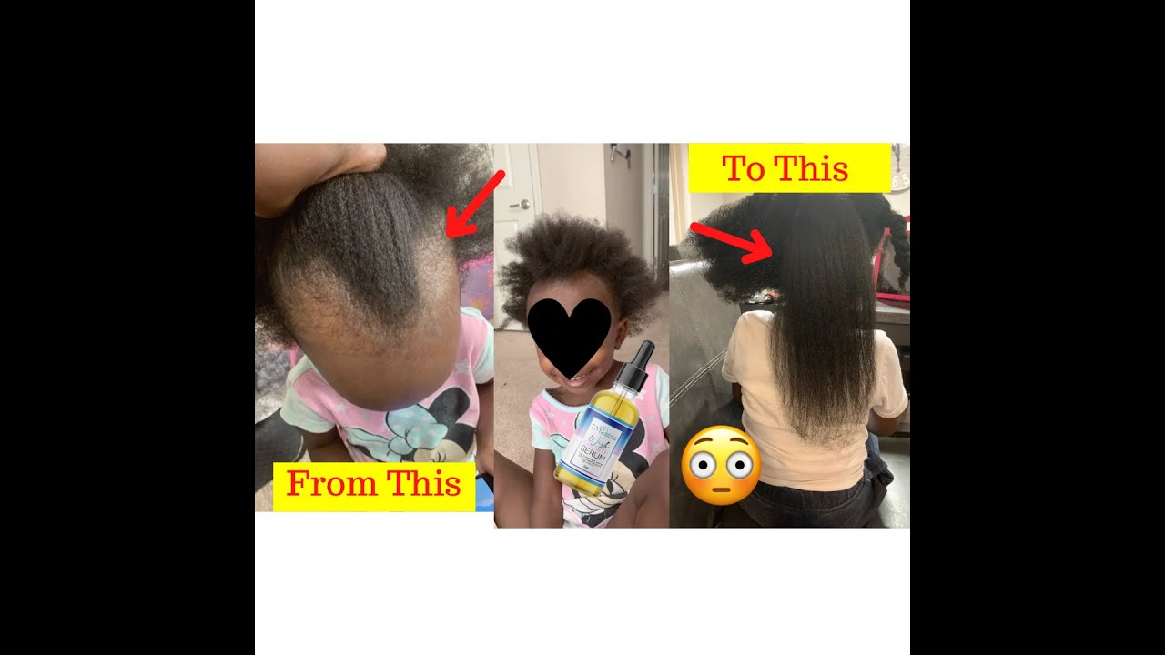 Natural kids 4c hair growth | your child’s hair will never stop growing for all hair growth￼