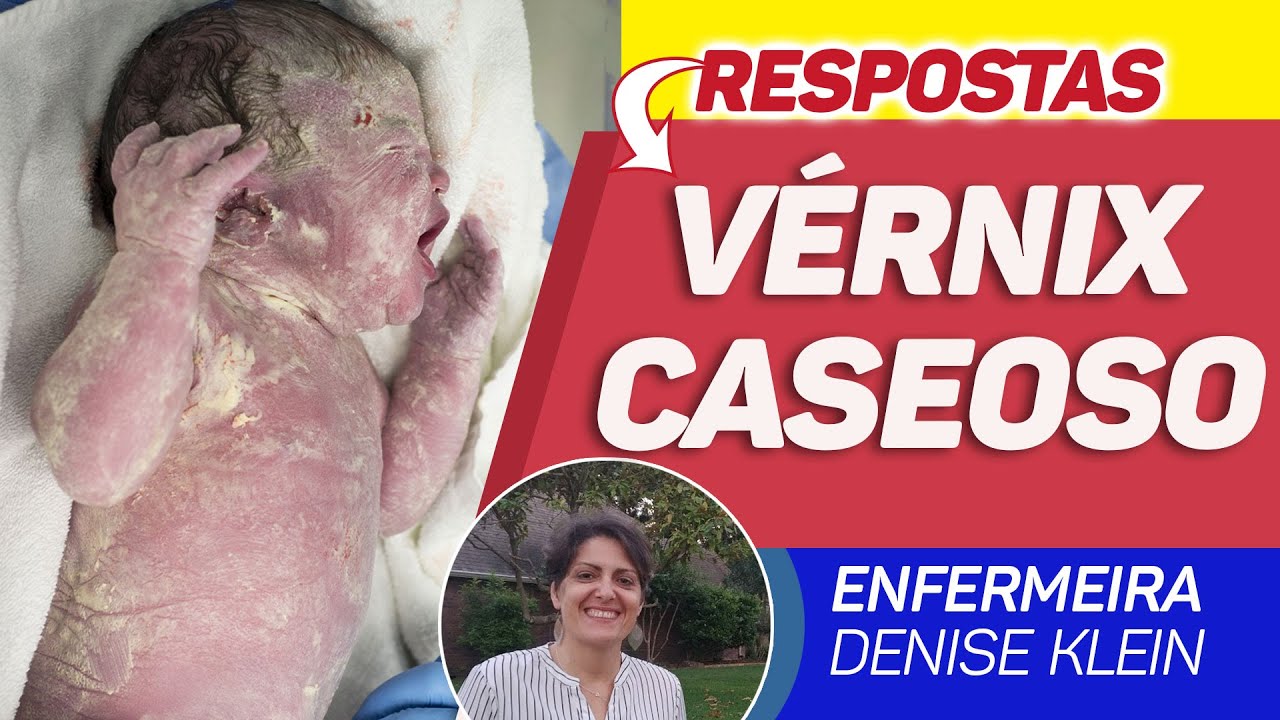 Vérnix Caseoso