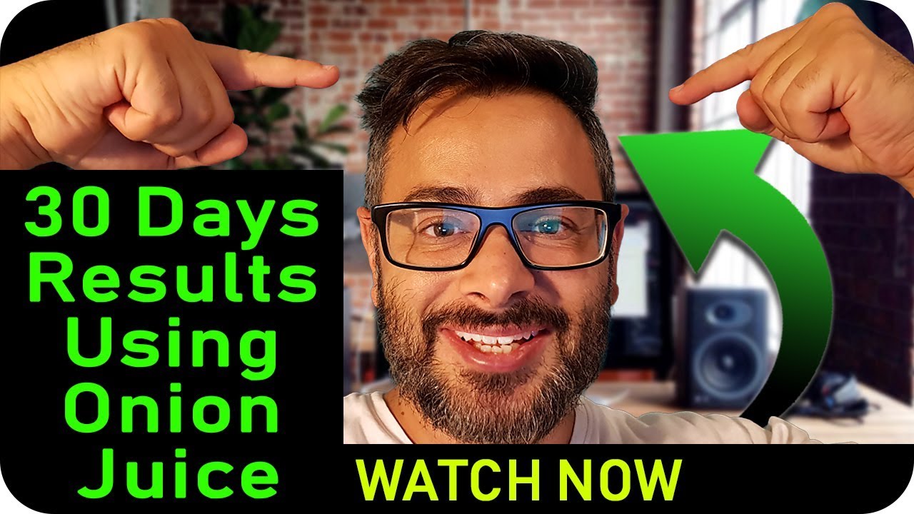 Onion Juice Hair Regrowth - 30 Days Before &After, Wow The Results!