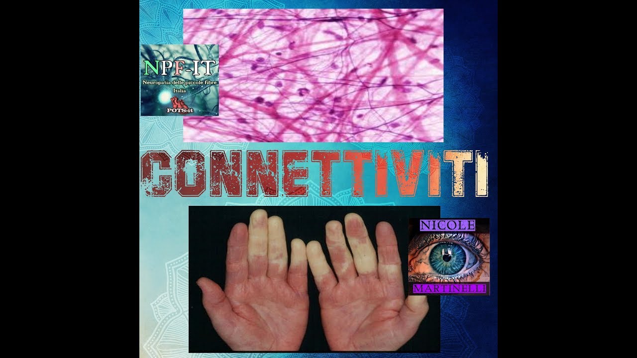 Connettiviti: cosa sono?