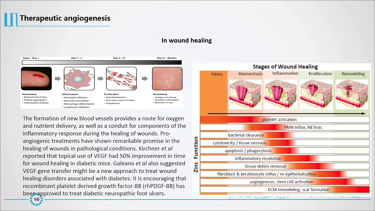 Angiogenesis