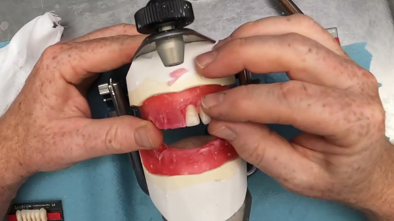 Complete Denture Course: Positioning Upper Anterior Teeth