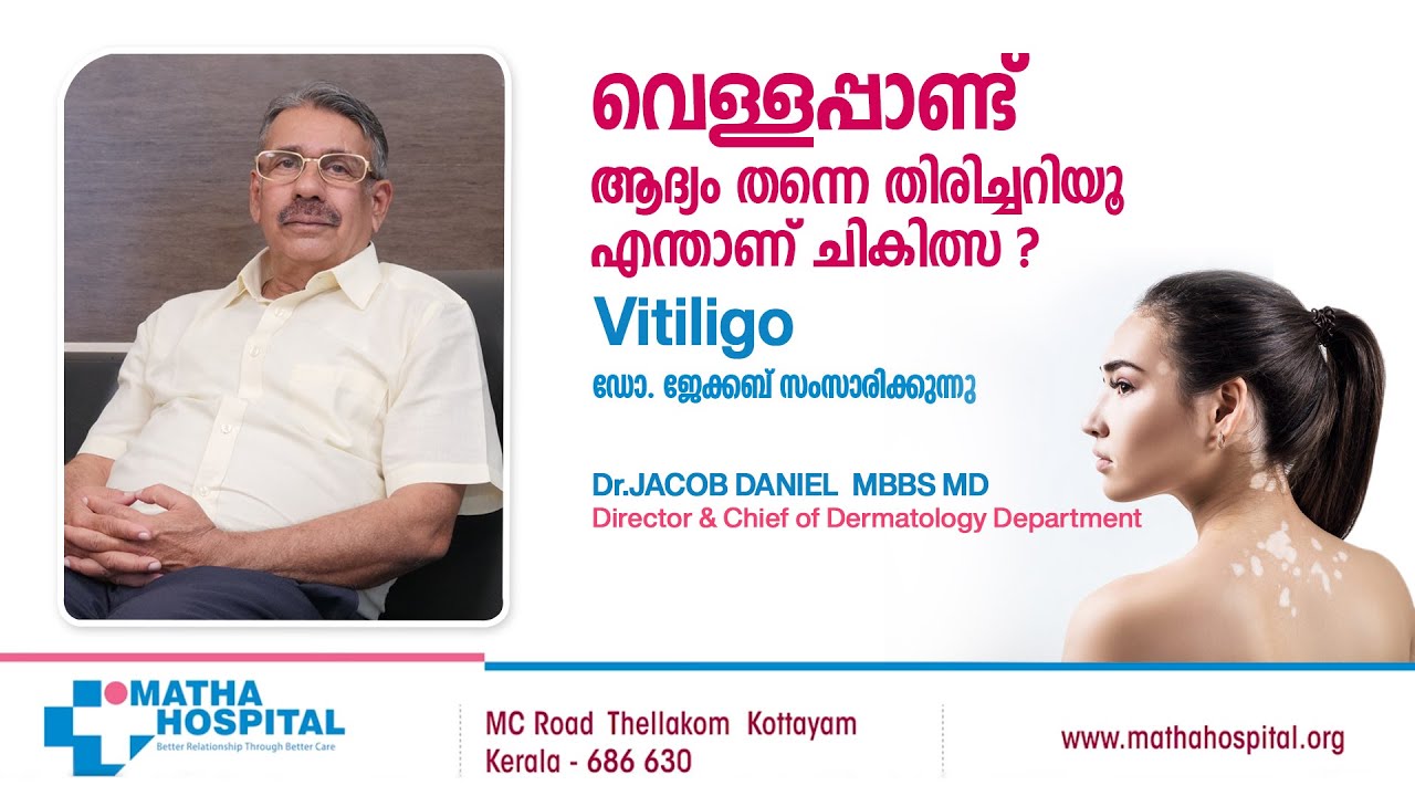 എന്താണ് വെള്ളപ്പാണ്ട്...? | 𝗠𝗮𝘁𝗵𝗮 𝗛𝗼𝘀𝗽𝗶𝘁𝗮𝗹