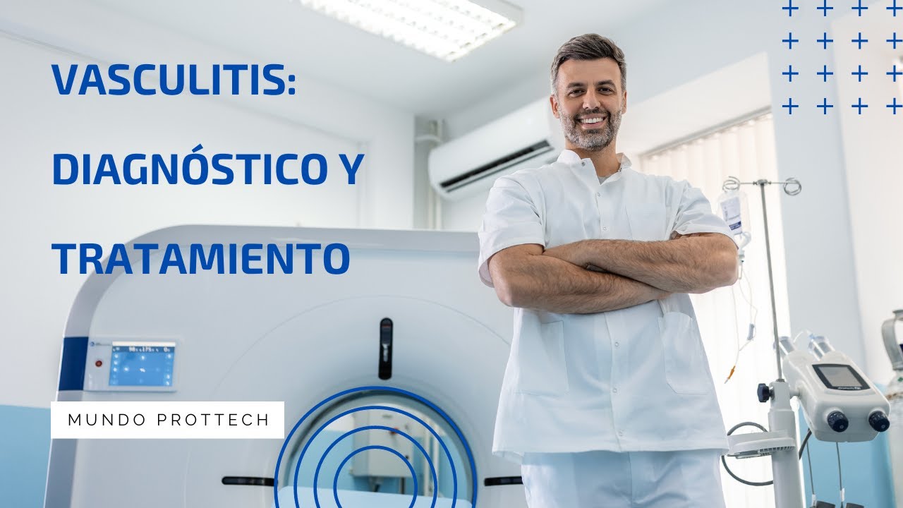 Vasculitis, diagnóstico y tratamiento: guía completa