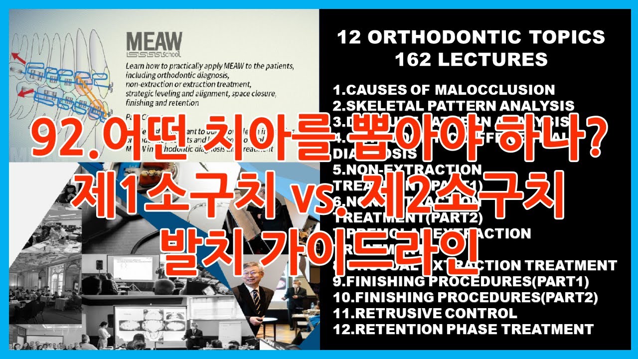 92.어떤 치아를 뽑아야 하나? - 제1소구치 vs. 제2소구치 발치 가이드라인