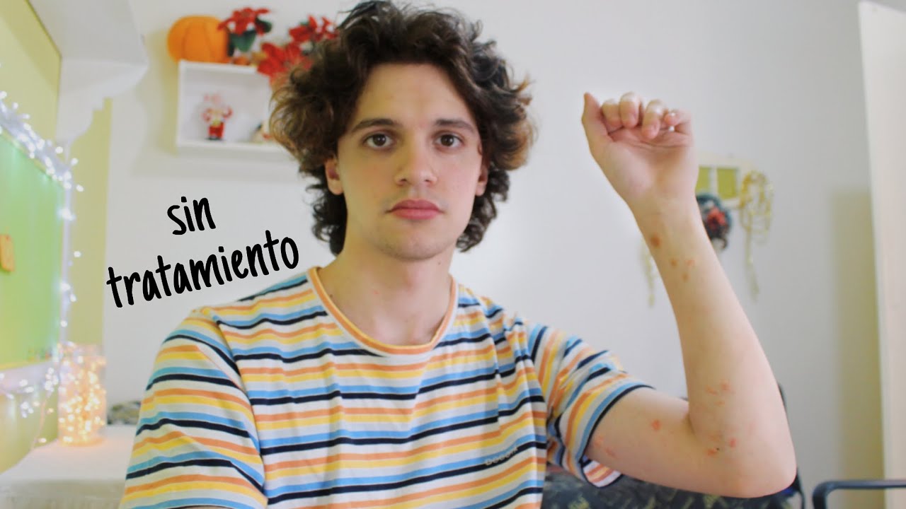 tengo una rara enfermedad
