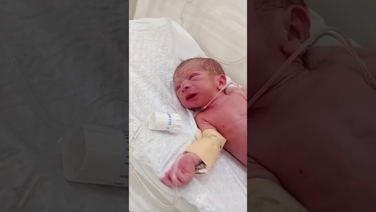 MashaAllah ,New Born Baby Health Improve in the Incubator After 24hours