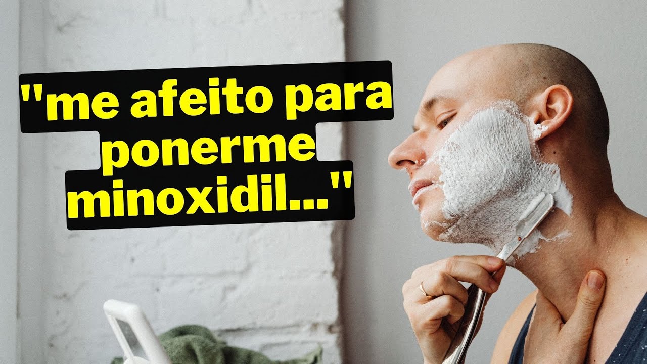 🧔&zwj;♂️ &iquest;Afeitar o Rebajar con Minoxidil? ✅ NO cometas estos ERRORES