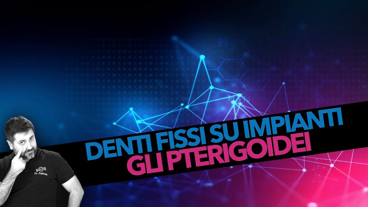 Dr Palmas: denti fissi su impainti con Impianti Pterigoidei