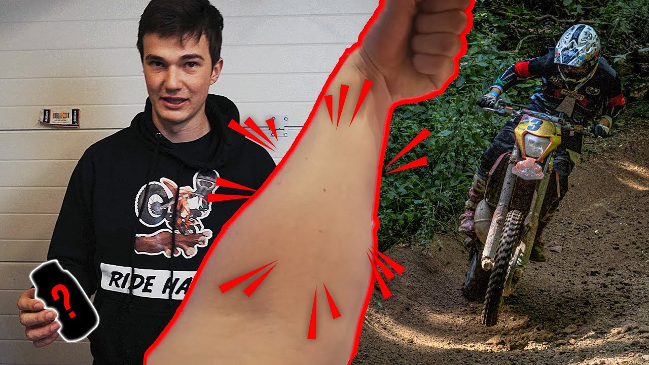 Kézbedurranás! 6 tuti tipp, amit a profi motorosok is alkalmaznak armpump ellen.