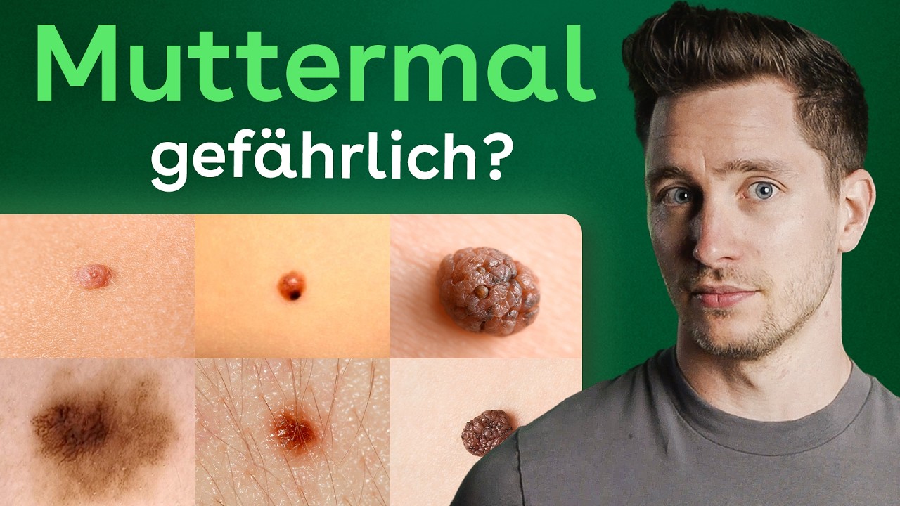 Muttermale: Wann solltest du zum Arzt?