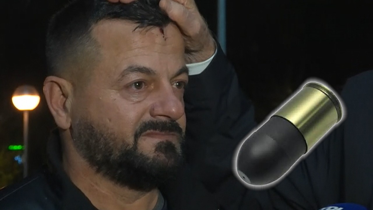 Berisha tregon plagën e qytetarit në kokë: Është goditur me snajper