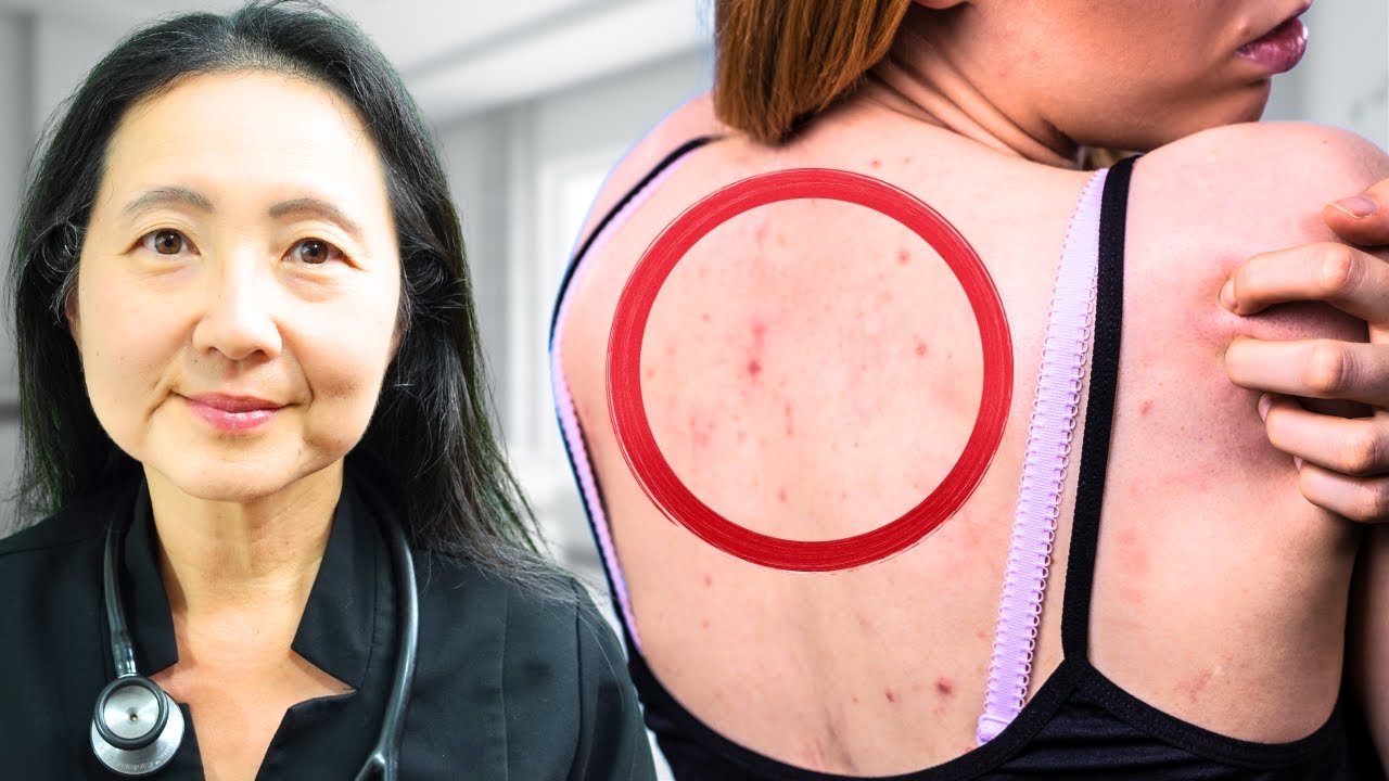 Inflammation: Missing 10 Signs of High Cortisol?