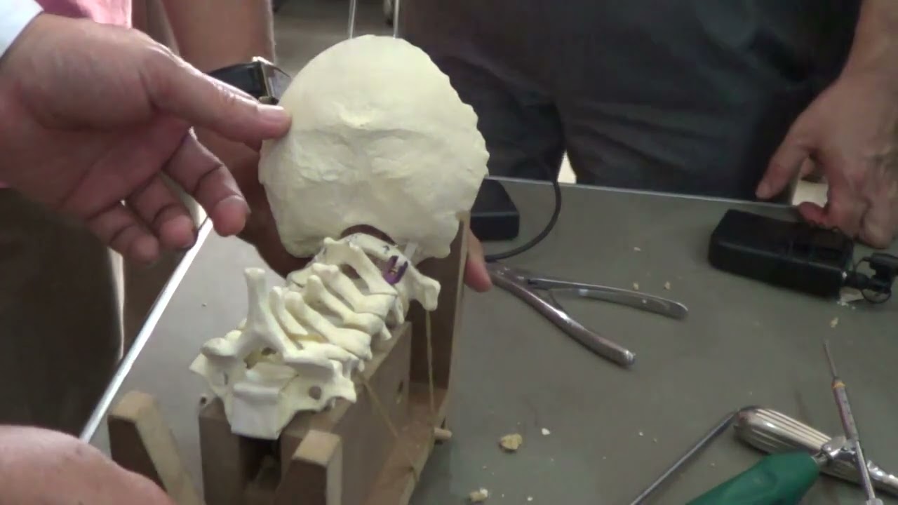 APSS Workshop: Posterior C1 C2 Fixation and Lateral Mass Fixation (7)