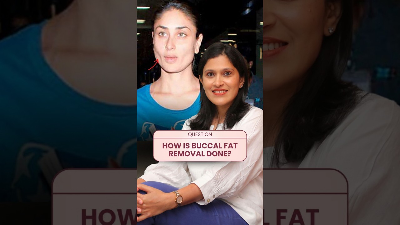 Get AMAZING Results with Buccal Fat Removal | Dr Amiti Shah