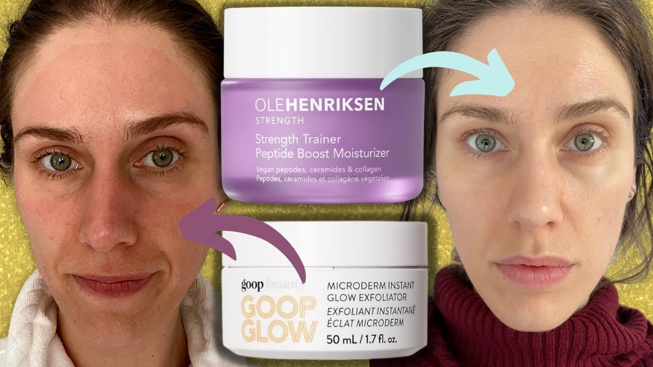 I Burned My Skin Off Then Fixed It. How To Train Your Face This Year