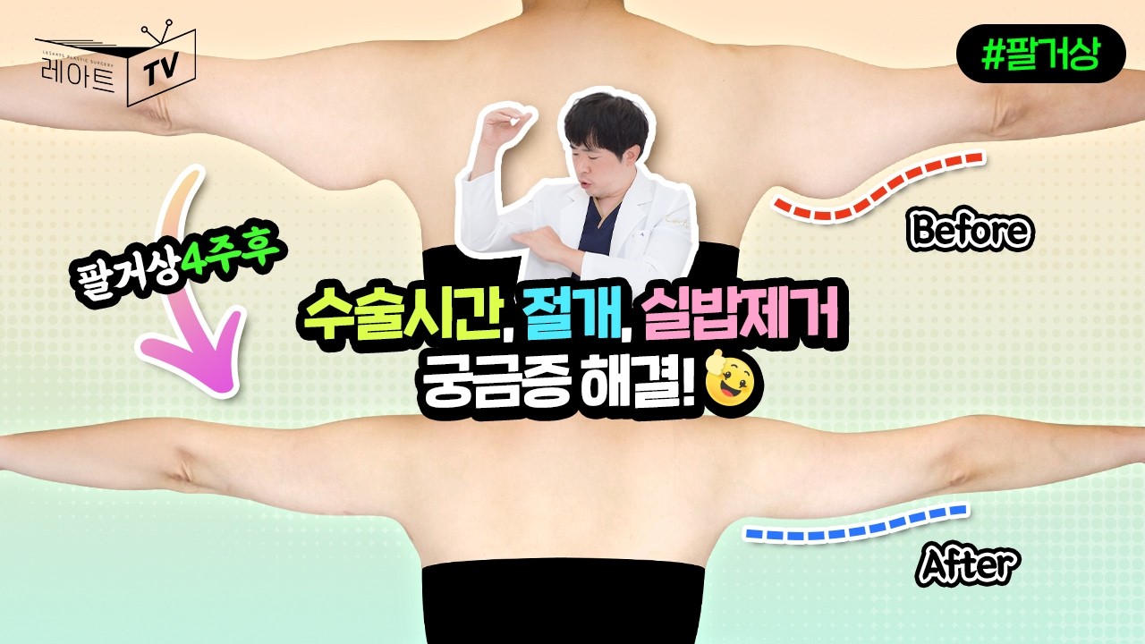 [팔거상수술] 절개, 수술시간,  실밥제거🤓쏟아지는 질문에도 척척 대답하는 이국한 원장님 [레아트성형외과]