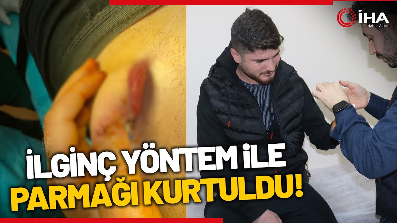 İlginç Yöntem! Kopan Parmağı Göbeğinde Yeniden Büyütüldü...