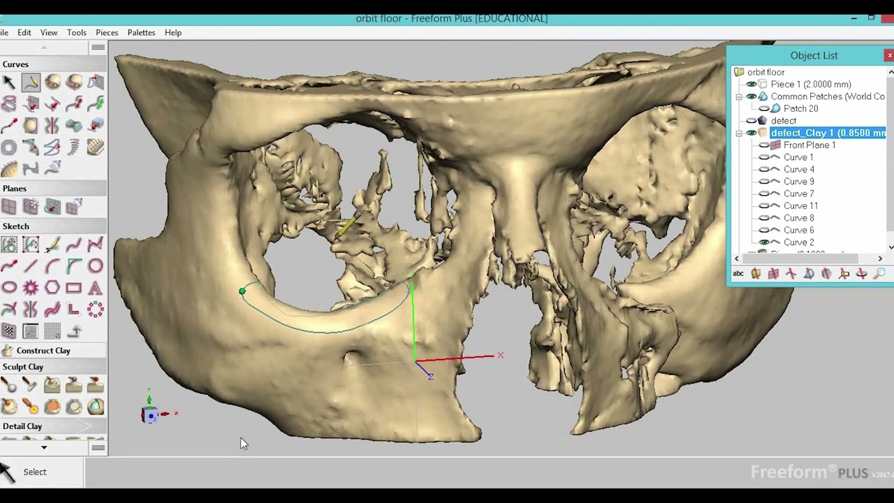 Orbital Mesh Model using Geomagic Freeform