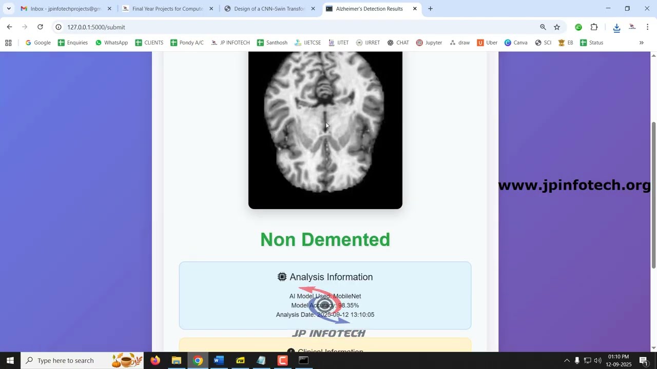 AI-Powered Alzheimer&rsquo;s Disease Detection using Deep Learning | Python IEEE Machine Learning Project