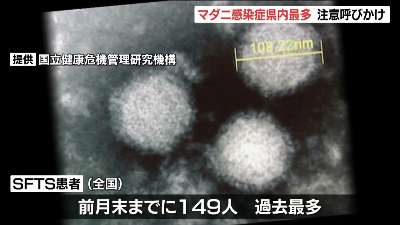 マダニ媒介感染症「SFTS」患者数が過去最多　全国で急増、大分県で13人