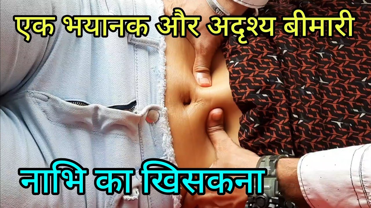 #Navel #ahmedabad #backpain #nabhi #dharan #chiropractic  9428038565