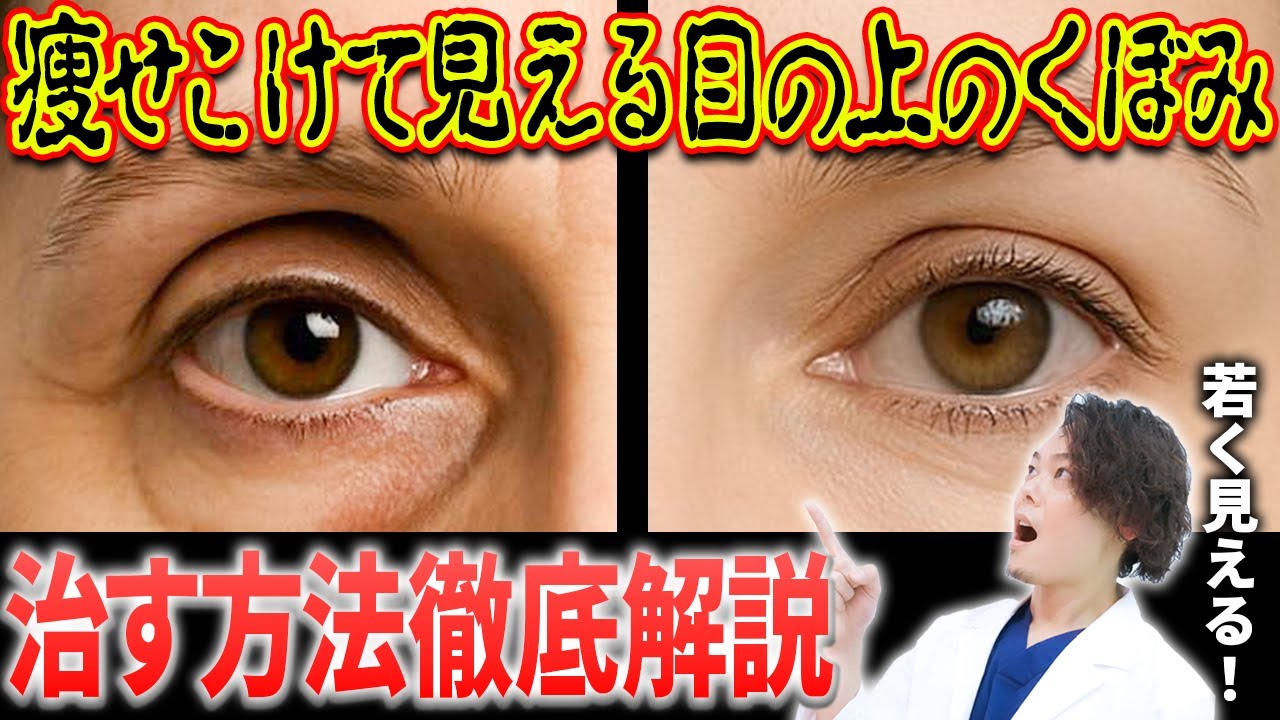 目の上のくぼみを治す方法について医師が徹底解説