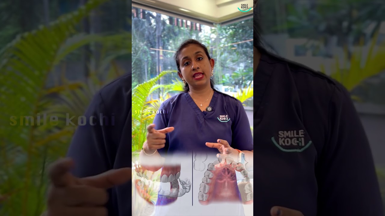 DIFFERENCES BETWEEN BRACES AND ALIGNERS?  Smile Kochi Dental Clinic