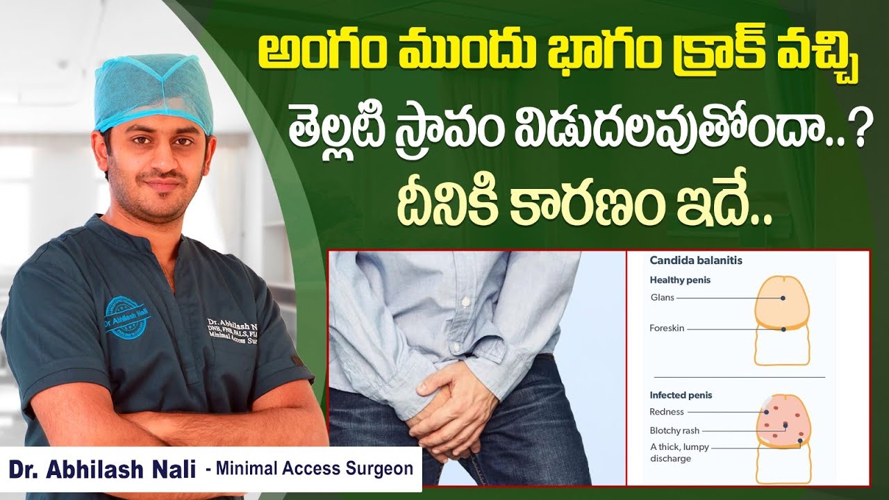 అంగం మీద ఇలా ఉంటే || Symptoms and Causes of Balanitis || Diabetes Signs in Men || Dr Abhilash Nali