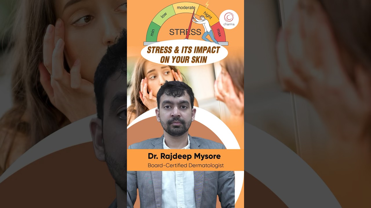 How stress affects your skin? - Dr. Rajdeep Mysore | Charma Clinic