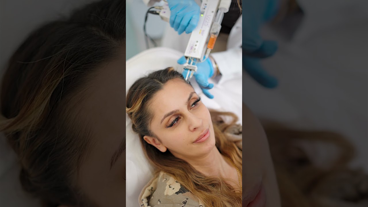 Revitalise Your Hair: Sidra's Journey with PRF Hair Treatment at Este Medical