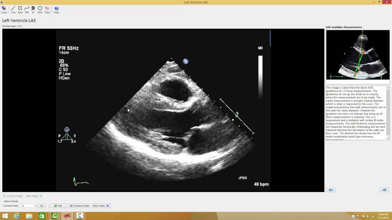 2  Echo Test and Teach Measurement Case