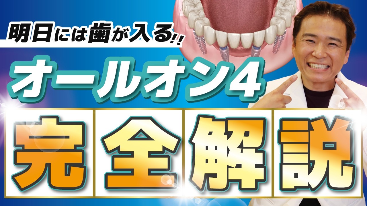 【完全解説】オールオン4インプラントの全てが分かる！